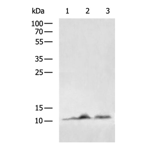MPC1 rabbit polyclonal antibody