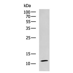 RPL35A rabbit polyclonal antibody