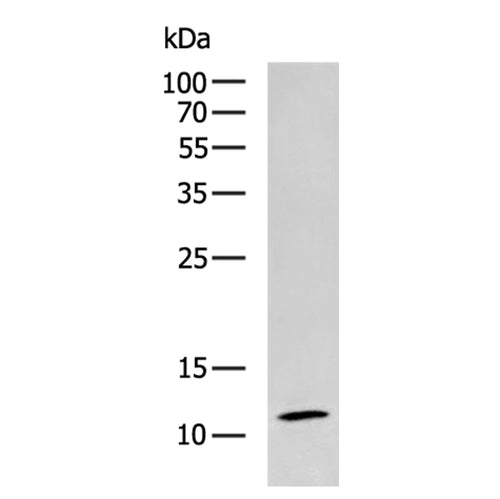RPL35A rabbit polyclonal antibody