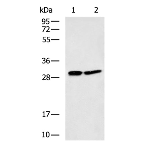 UBE2J2 rabbit polyclonal antibody