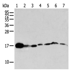 NUDT2 rabbit polyclonal antibody