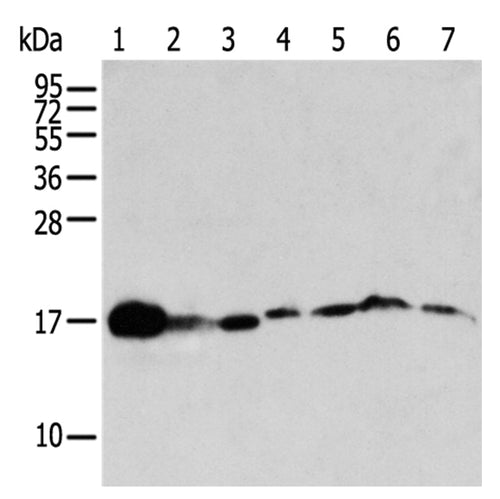 NUDT2 rabbit polyclonal antibody