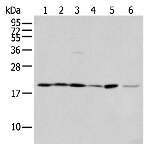 EEF1E1 rabbit polyclonal antibody