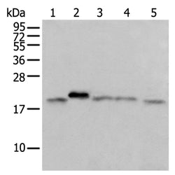 GM2A rabbit polyclonal antibody