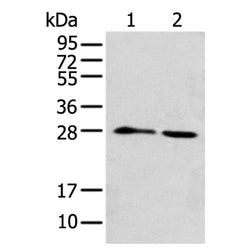 DENR rabbit polyclonal antibody