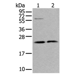 ABHD14B rabbit polyclonal antibody