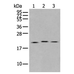 GINS4 rabbit polyclonal antibody