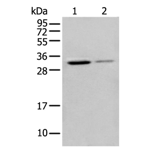 ING5 rabbit polyclonal antibody