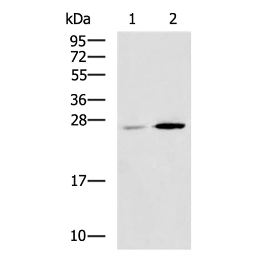 CBR4 rabbit polyclonal antibody