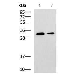 ASB9 rabbit polyclonal antibody