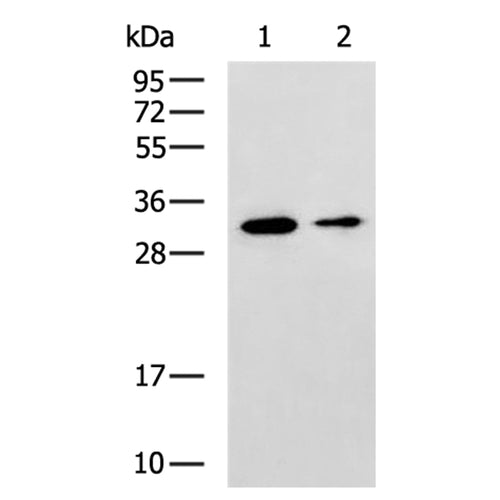ASB9 rabbit polyclonal antibody