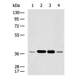 LASP1 rabbit polyclonal antibody