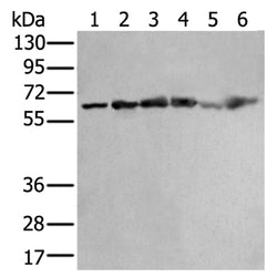 ZNF496 rabbit polyclonal antibody