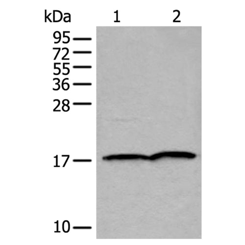 UBE2V2 rabbit polyclonal antibody