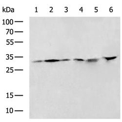 UTP11 rabbit polyclonal antibody