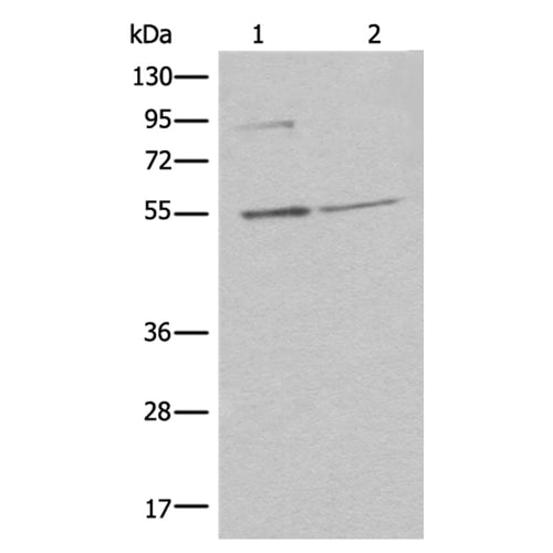 TEDC1 rabbit polyclonal antibody