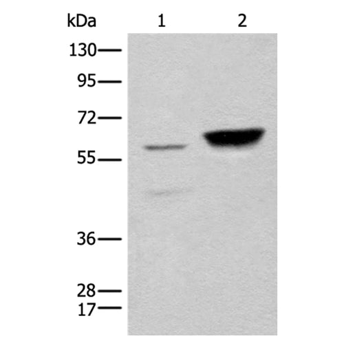 CCDC181 rabbit polyclonal antibody