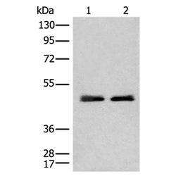 CHIT1 rabbit polyclonal antibody