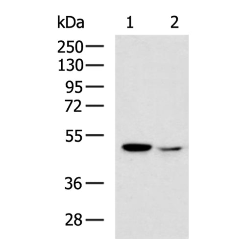 CS rabbit polyclonal antibody