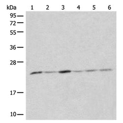 CMPK1 rabbit polyclonal antibody