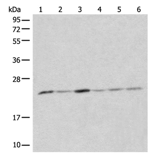 CMPK1 rabbit polyclonal antibody