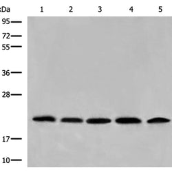 COMMD1 rabbit polyclonal antibody