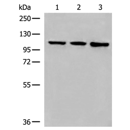 DDX54 rabbit polyclonal antibody