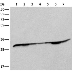 RSU1 rabbit polyclonal antibody