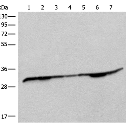 RSU1 rabbit polyclonal antibody