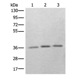 RBM11 rabbit polyclonal antibody