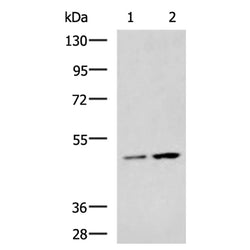 MAGEA11 rabbit polyclonal antibody