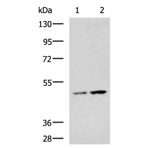 MAGEA11 rabbit polyclonal antibody