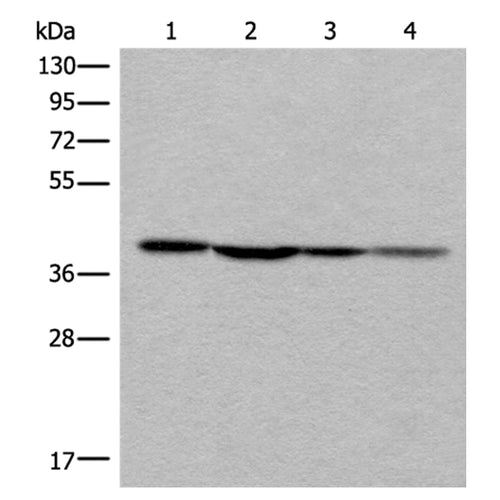 ROM1 rabbit polyclonal antibody