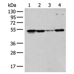 RRP1 rabbit polyclonal antibody