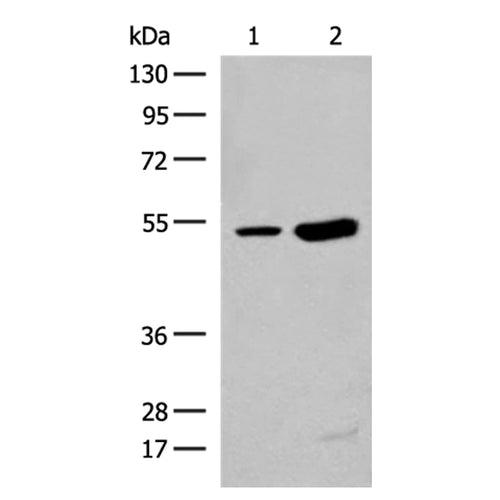 ZBTB43 rabbit polyclonal antibody