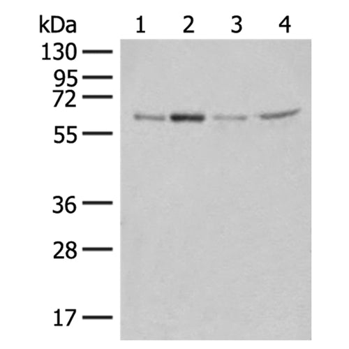 ZGPAT rabbit polyclonal antibody