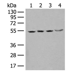 SHMT2 rabbit polyclonal antibody