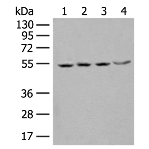 SHMT2 rabbit polyclonal antibody