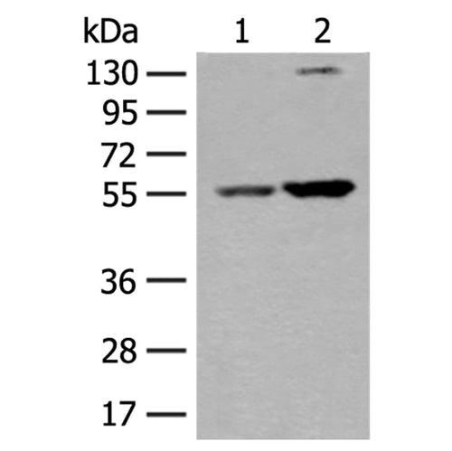 XPNPEP3 rabbit polyclonal antibody