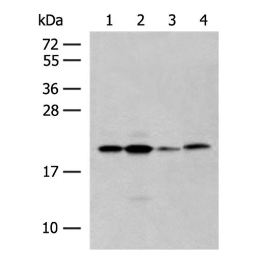 RNF5 rabbit polyclonal antibody