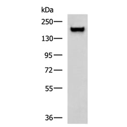 ACE rabbit polyclonal antibody
