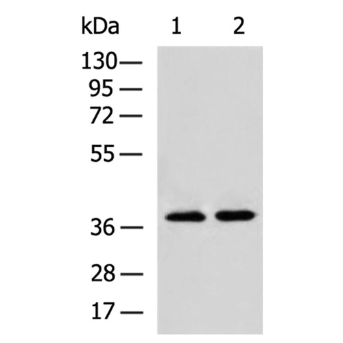FOXN2 rabbit polyclonal antibody
