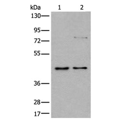 GSK3B rabbit polyclonal antibody