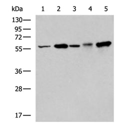 IL15RA rabbit polyclonal antibody