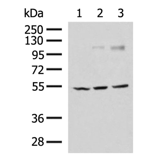 CHRNA1 rabbit polyclonal antibody