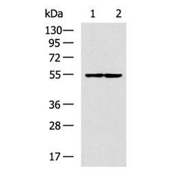 LPCAT4 rabbit polyclonal antibody