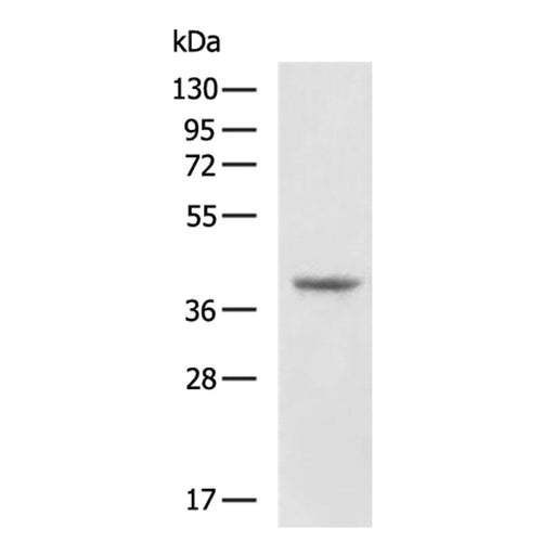 TRIM63 rabbit polyclonal antibody