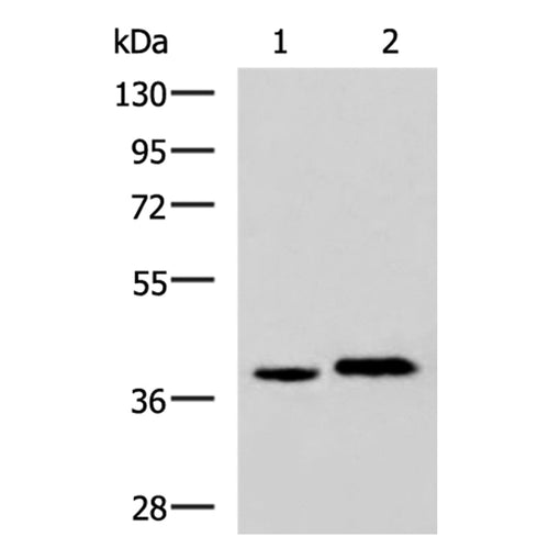 PLPPR5 rabbit polyclonal antibody