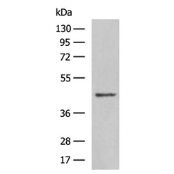 NCR1 rabbit polyclonal antibody