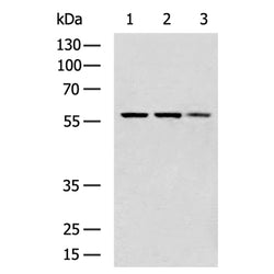 CYP46A1 rabbit polyclonal antibody